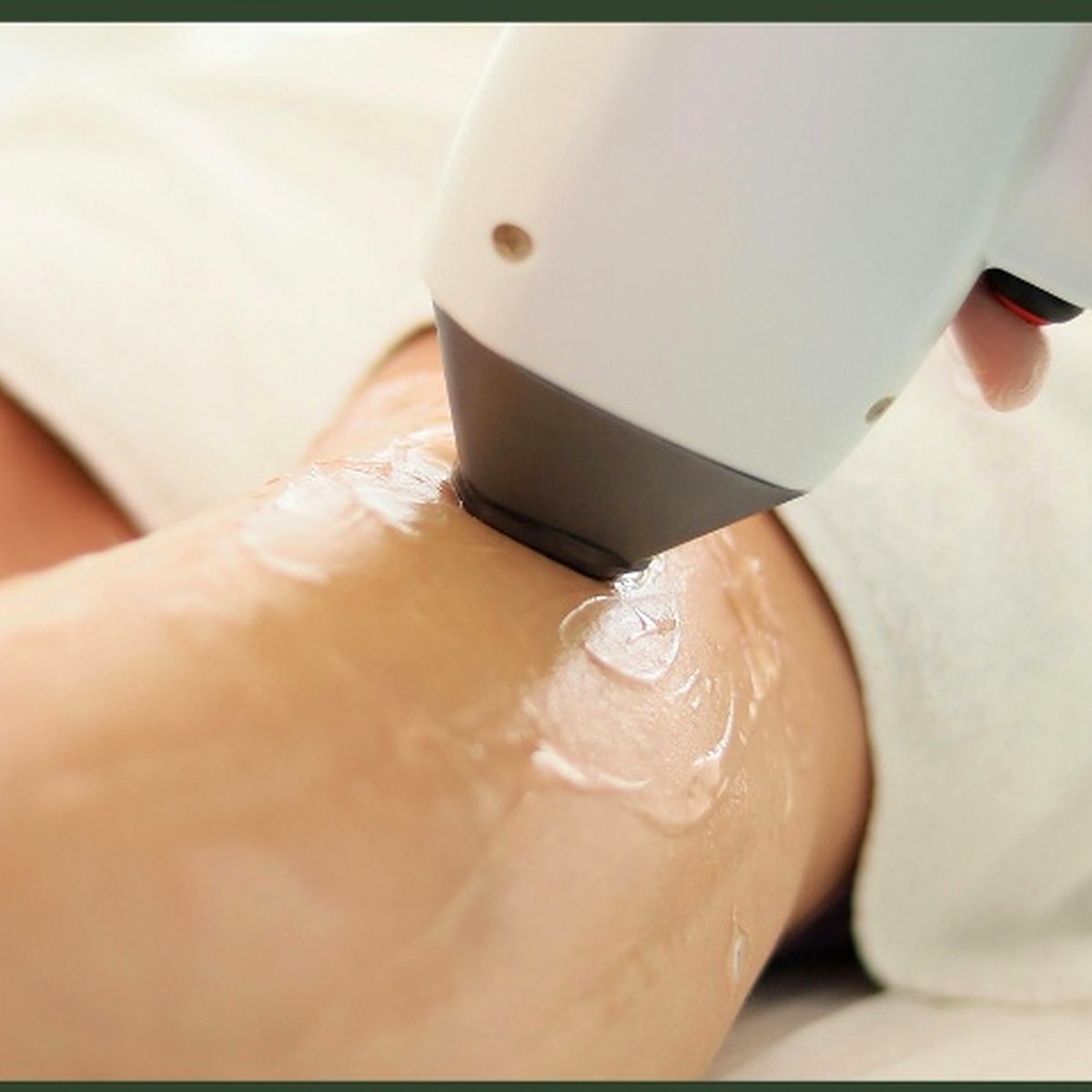 Revela Skin – épilation laser